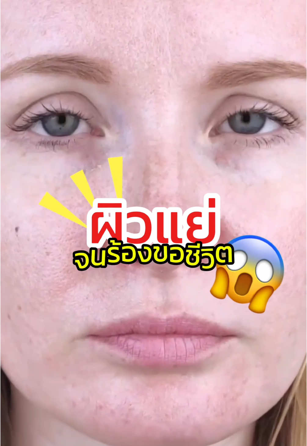 ผิวมัน = ผิวแย่จนร้องขอชีวิตเลยนะ 😱‼️ #Skinoxy #สกินแคร์ไทยที่จริงใจ #skincare #tiktok #ตะกร้าtiktokshop #ilovetiktok #fyp #cleaning #cleanser #acne #ล้างหน้าลดสิว #สิว #ล้างหน้า #สะอาด #skin #ผิวมัน #oilyskin 