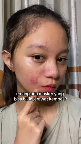 #chierraglowupmask #chierrabeauty #mask #acnefighter #acneskin #acneproneskin #acne #fypシ #affiliate #trending #fypage #fyppppp 