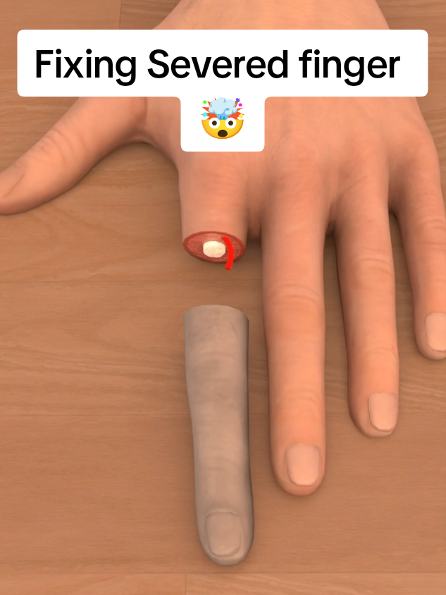 Can You Reattach a Finger? 🩸🖐️#FingerReattachment  . . #SeveredFinger #3DAnimation #MedicalScience #HowItWorks #BodyHealing #SurgeryExplained #3dgarage 