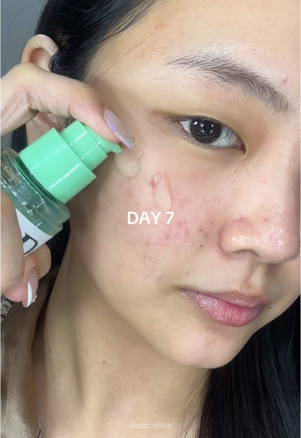 Trying out the viral purito serum for a week & the result is 🙀 Product: Purito Wonder Relief Centella Serum Unscented ᯓᡣ𐭩 YesStyle Code: MINA007 ᯓᡣ𐭩 Olive Young Code: JJONGMINA7 . . . #kbeauty #kbeautyskincare #koreanskincare #skincare #skintok #centella #glow #soothing #purito #puritoseoul #acneprone #fyp #yesstyle #yesstyleinfluencers #yesstylecode #oliveyoung #oliveyoungglobal #oliveyoungaffiliate @PURITO SEOUL @YesStyle @YesStyleInfluencers @OLIVE YOUNG Global 