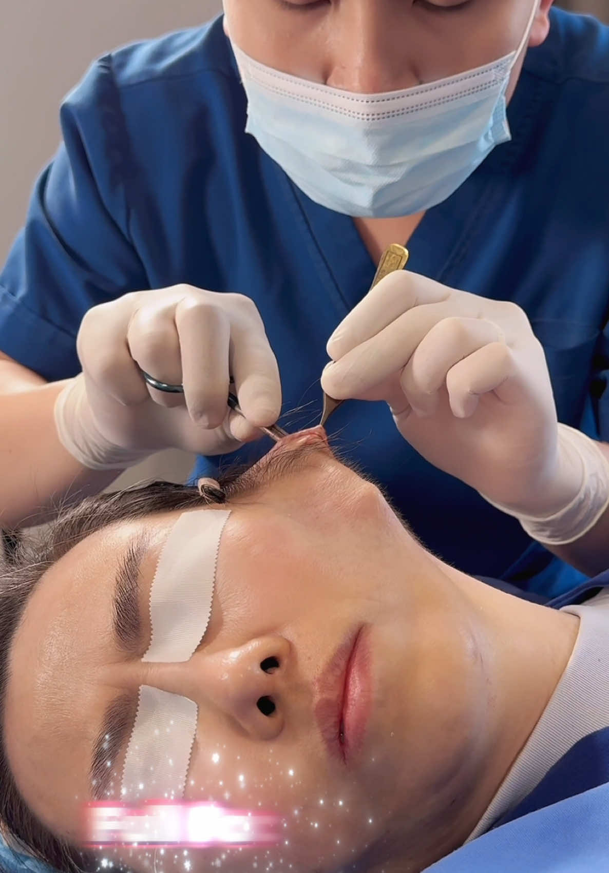 Regenerate skin structure, lift facial muscles, firm and rejuvenate skin. #comesticsurgery #minifacelift #facelifting #facelift #fyp #kualalumpur #kualalumpurmalaysia #tiktokmalaysia #malaysia #drwonyang 