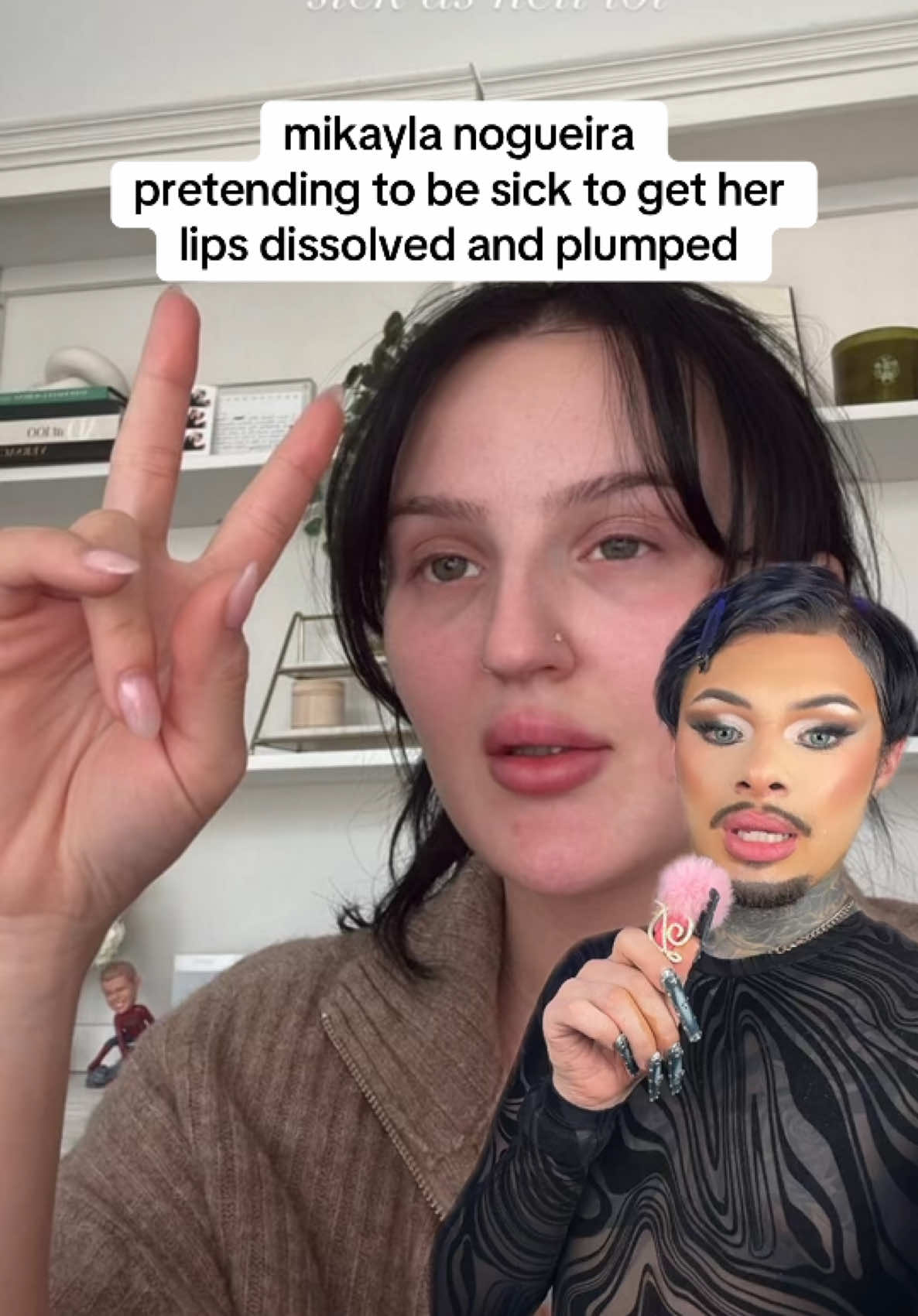 #mikaylanogueira #lipfiller   #dissolvinglips #danteonika