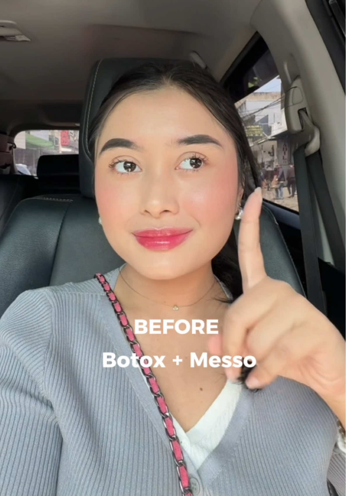 gila loh dulu sekotak itu muka??!!😭 #botox 