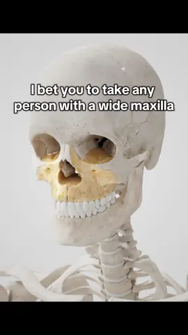 #Maxilla affects EVERY other bone in your face. Wide maxilla: pushes cheekbones out protects eye area allows lower jaw to develop projects chin leads to hollow cheecks expands your airways improves sleep improves cognitive functioning  #looks #looksmaxing #looksmax #mewing #mewingshop #mogged #GlowUp #SelfImprovement #mew #transformation #jordanbarrett #mogger #chicolachowski #yochico #chico #expander #seanopry 