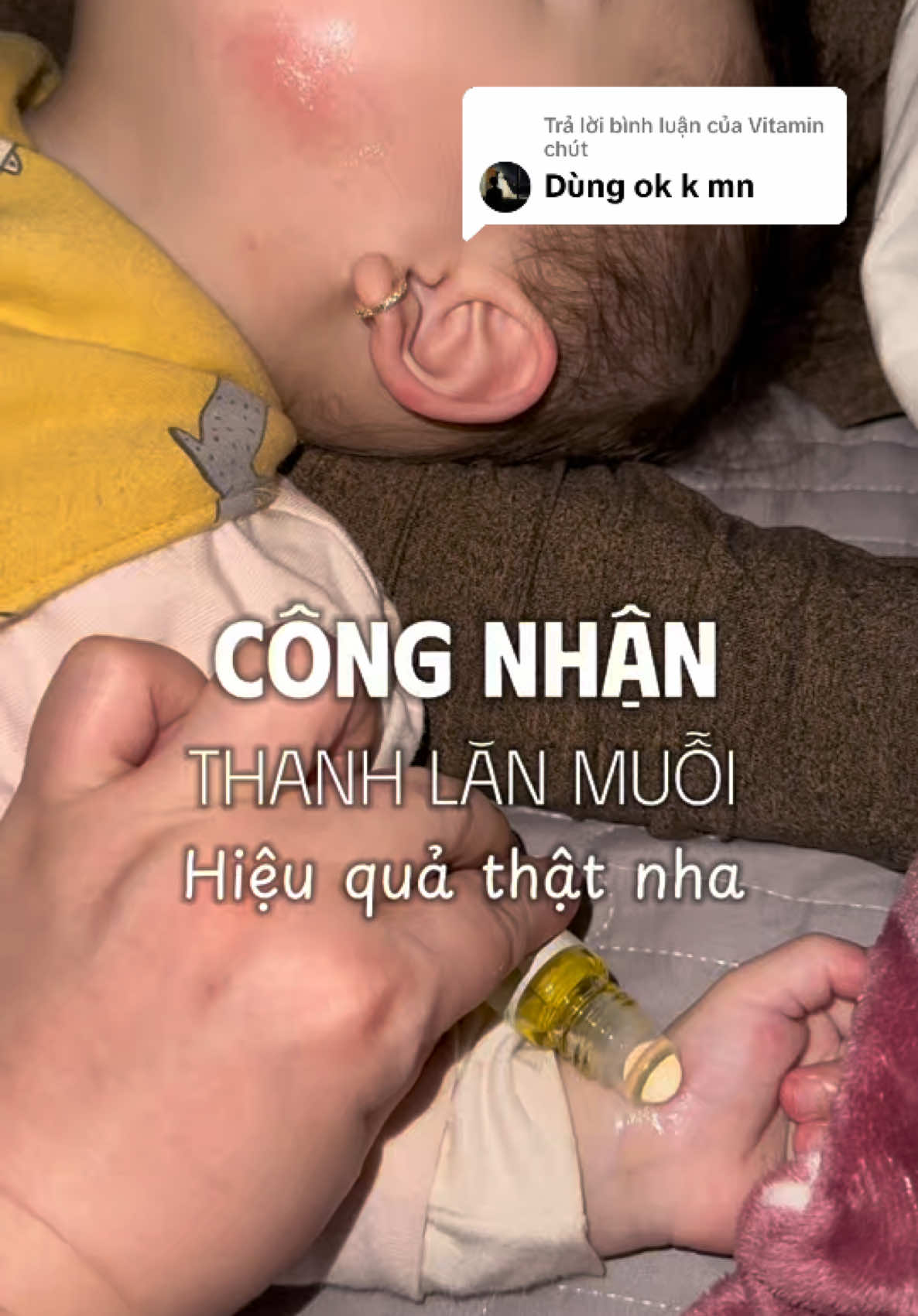 Trả lời @Vitamin chút Công nhận thanh lăn muỗi này hiệu quả thật nhé. #muoidot #pozomos #thanhlanmuoidot #kemboimuoidotchobe #kemboimuoidot 