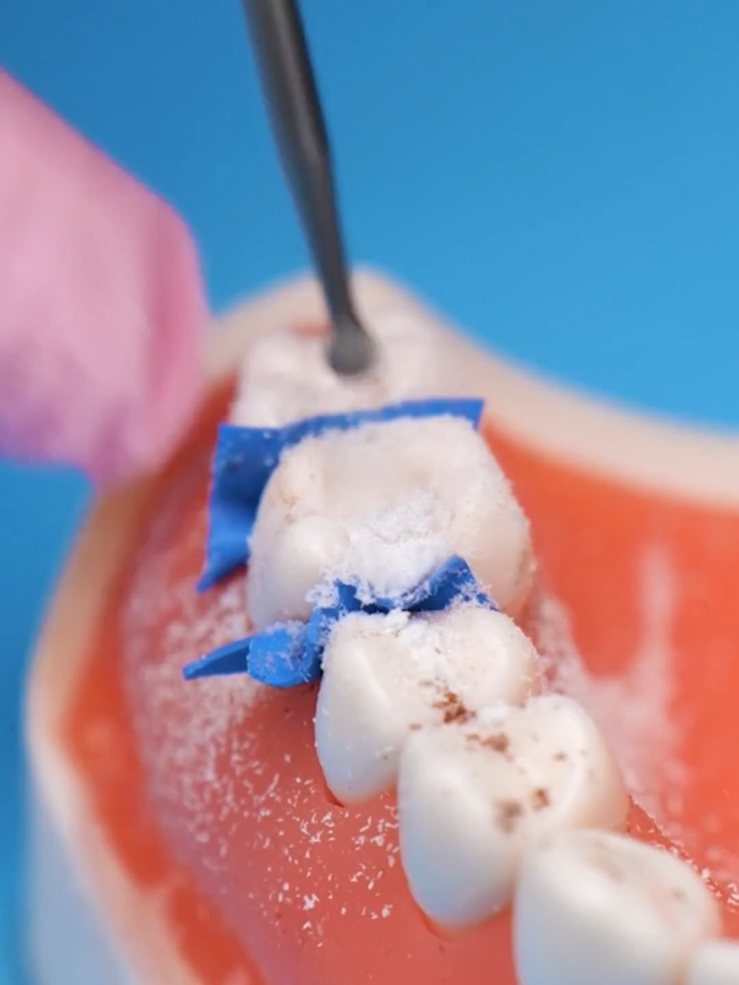 Reminder to take care of your teeth! 🦷🤓  #howto #doctor #dentist #craft #oralhygiene #fyp #5mc #restoration 