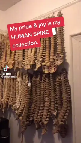 Human Bone collection. 