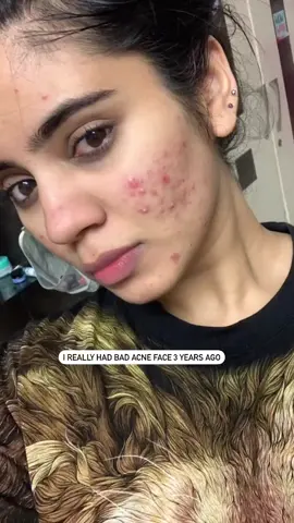 #glowing #skin ❤️