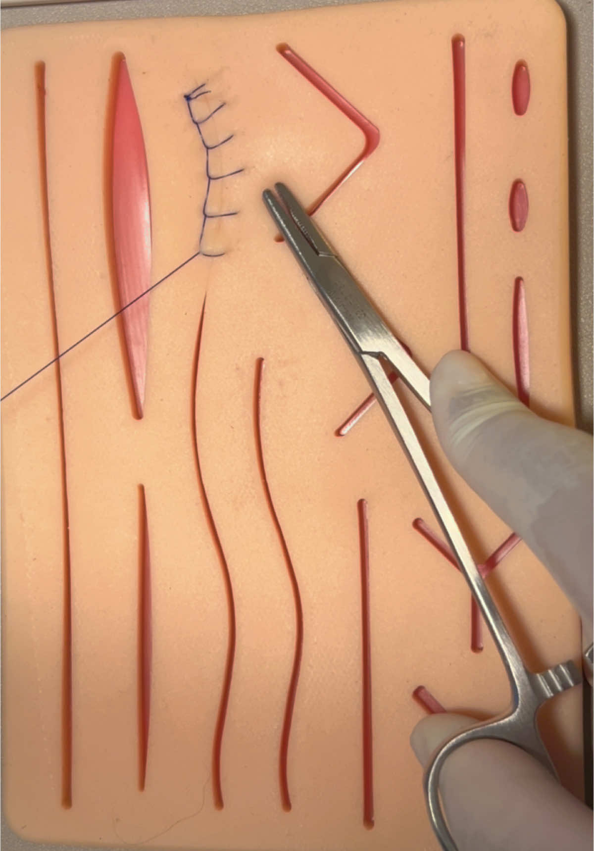 Belajar tehnik jahit luka / hecting interloking suture 😗😗 #perawat #nurse #nakes #fyp #keperawatan💊💉 