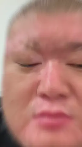 Cách chữa lang ben thời đại 4.0 đơn giản hiệu quả nhất