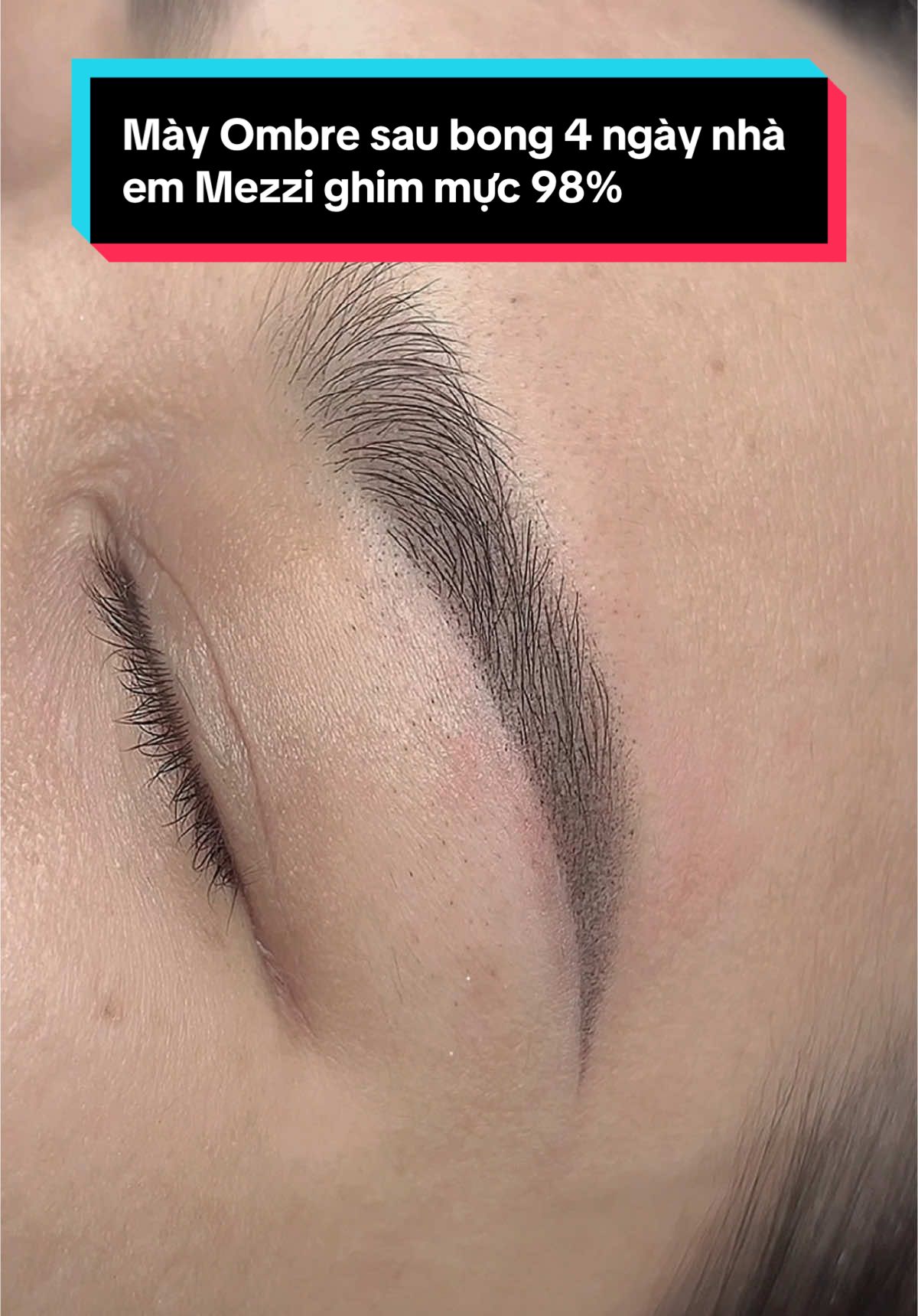 Kỹ thuật Mày Ombre sau bong 4 ngày nhà em Mezzi ghim mực 98% siêu tự nhiên và mực bao k bị trổ xanh trổ đỏ nhé ạ . Inbox để em tư vấn nhé ạ 💗 #xuhuong #viral #trending #chuyenphunxamthammy #chuyentiemfillerbotox #phunxamgovap #phunxamthuduc #mezzi_beauty #mezzi_75 #phunmaydep #phunmayombre 