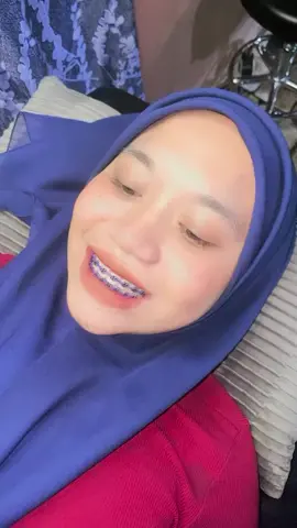 braces area kuala terengganu #fyp #braces #bracesbysyaaabeauty #fashion #terengganu 