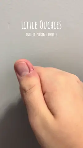 whether you have a bad habit you need to kick or are struggling mentally @Little Ouchies is here to help you through your journey✨ not only has this helped mentally during my anxious moments but physically, LOOK AT MY NAILS! I am so happy with the results and definitely recommend you giving this a try! #littleouchies #littleouchiesgrippies #MentalHealth #mentalhealthmatters #fidget #fidgettoys #anxiety #stress #stimming 