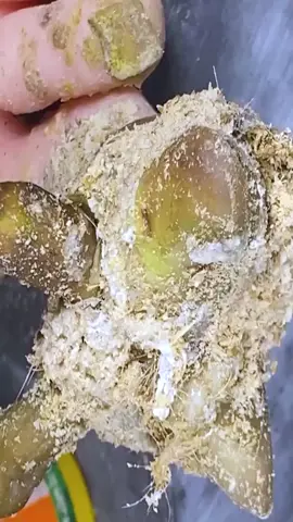 Unbelievable Toenail Fix in the USA! 🇺🇸 #USA #AmericanToenail #ToenailCare #SatisfyingNail #NailFixUSA #AmericanHealth #USAToenailCare #MadeInUSA #TrendingInUSA Disclaimer: These videos are sourced from other platforms, Video Credit to Vietnamese group. They feature artificial toenails for educational and monetization purposes.