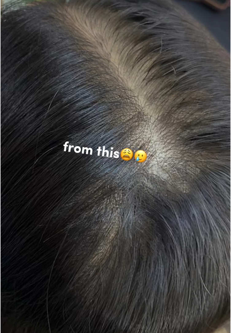 rambut makin sehat gara gara iniiii🫶🏻🫶🏻 #labonhair #growthstartshere 