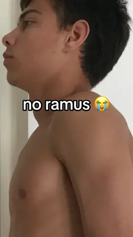 ramus #mog #debloat 