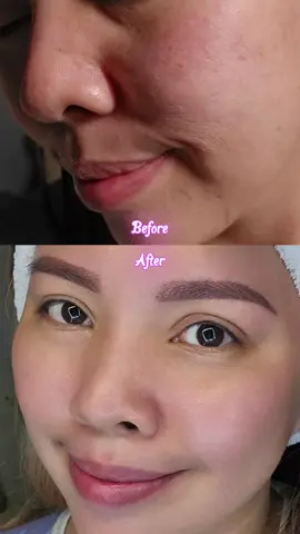 Instant lifting, deep hydration, and a youthful glow—Aurora White Beauty Age Renewal Ampoule is the anti-aging secret your skin needs! ✨ Add to cart now! #AgelessGlow #KoreanSkincare #GlassSkin #WrinkleFree #YouthfulGlow #SkinRejuvenation #GlowUp #HydratedSkin #CollagenBoost #SkincareEssentials @aurorawhite.beauty 