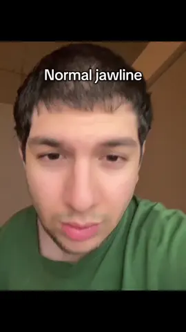 Brutal. #bp #tajikchad #fyp #xyz #mog #jawline#looksmax #chicolachowski #marlon #jordanbarrett #damiankater #edit #adrianalima #mewing #handsome #beauty #model #looks #zeta #archie #chico #orb #cameronalborzian #unkownslayer #genetics #pslgod #mogged #looksmatter