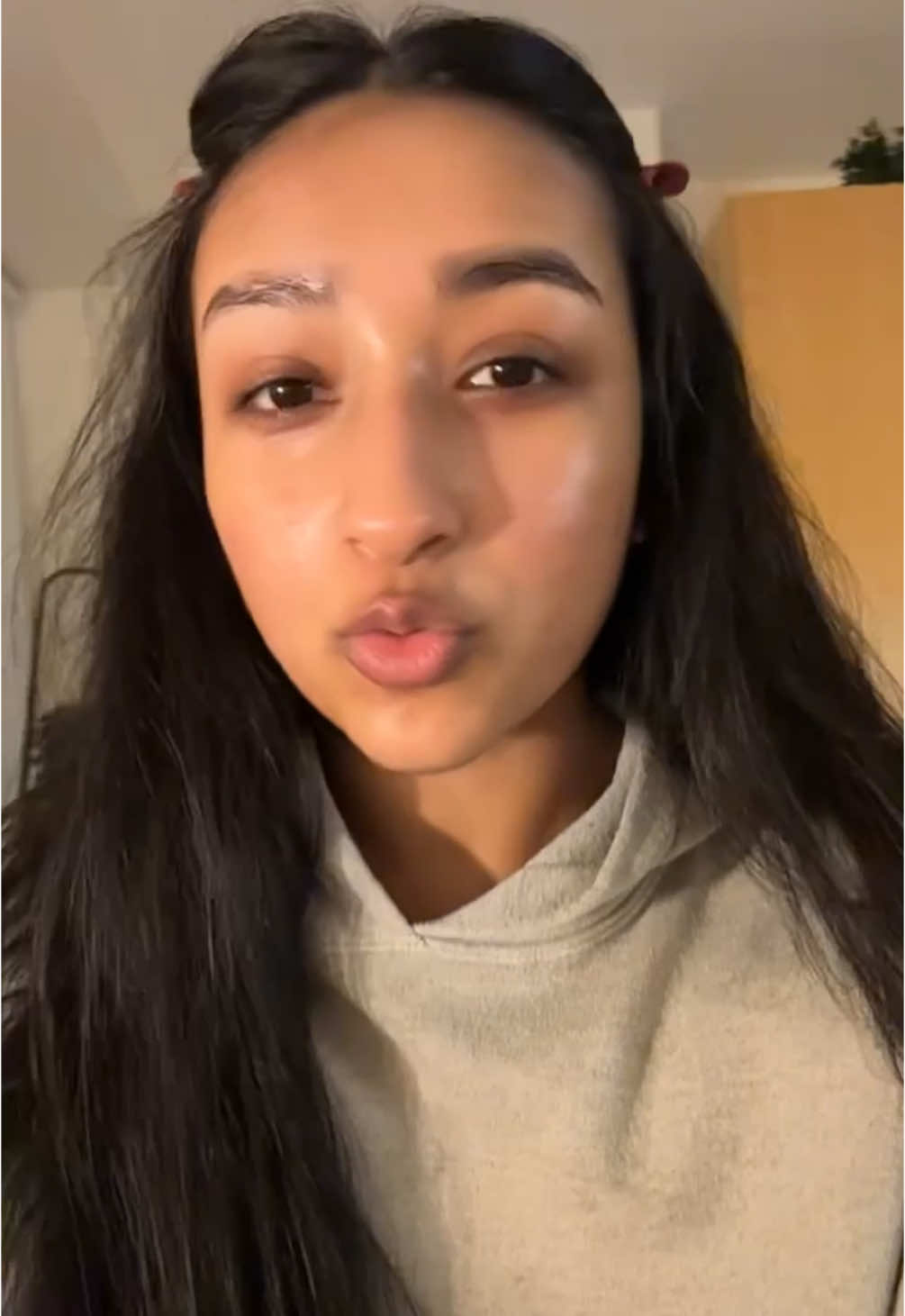 Hormonal acne at 20, clear skin at 21 #fypシ #skincare #skintok #acnescars #acneproneskin #koreanskincare 