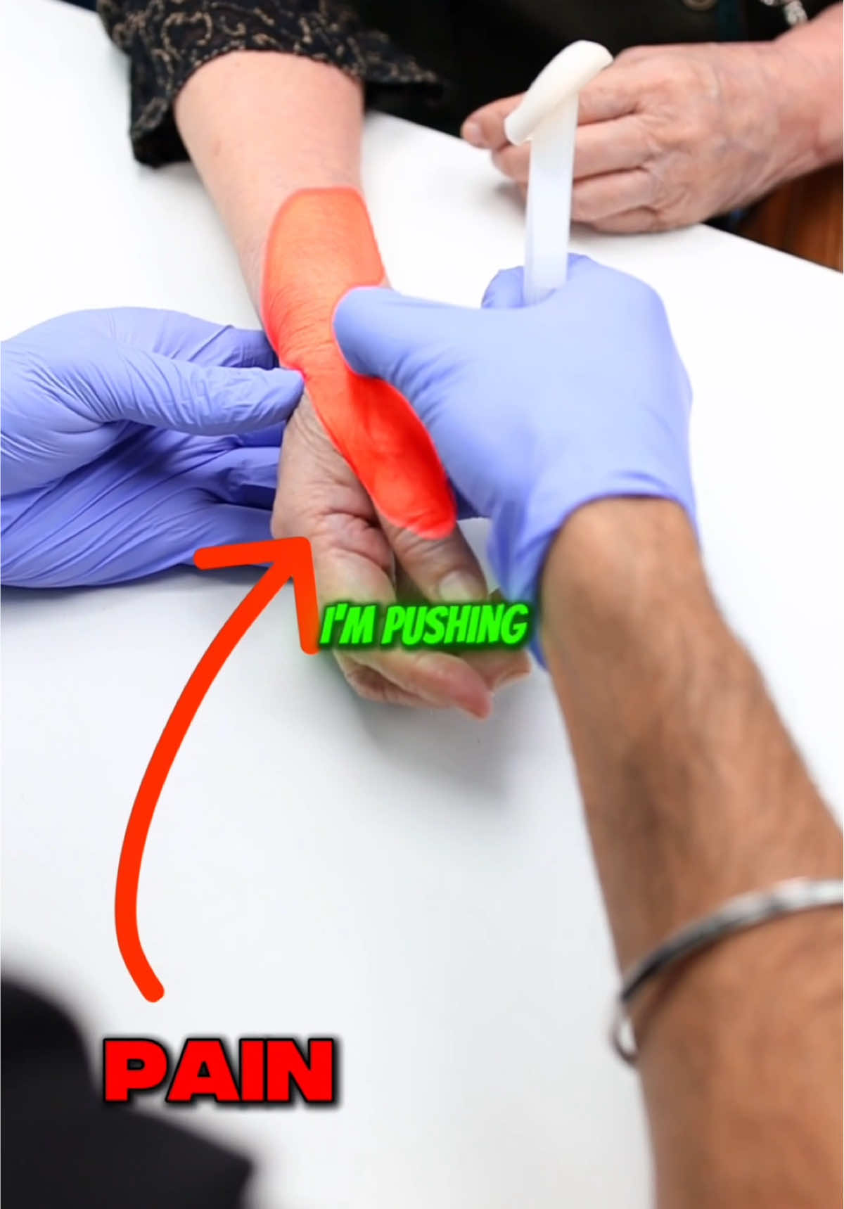 How to ease arthritis pain in thumb joint? Arthritis in the thumb area (CMC joint) can make even simple tasks painful. A steroid injection can help reduce inflammation and provide relief, making daily activities easier! #painmanagement #painrelief #arthritis #medical 