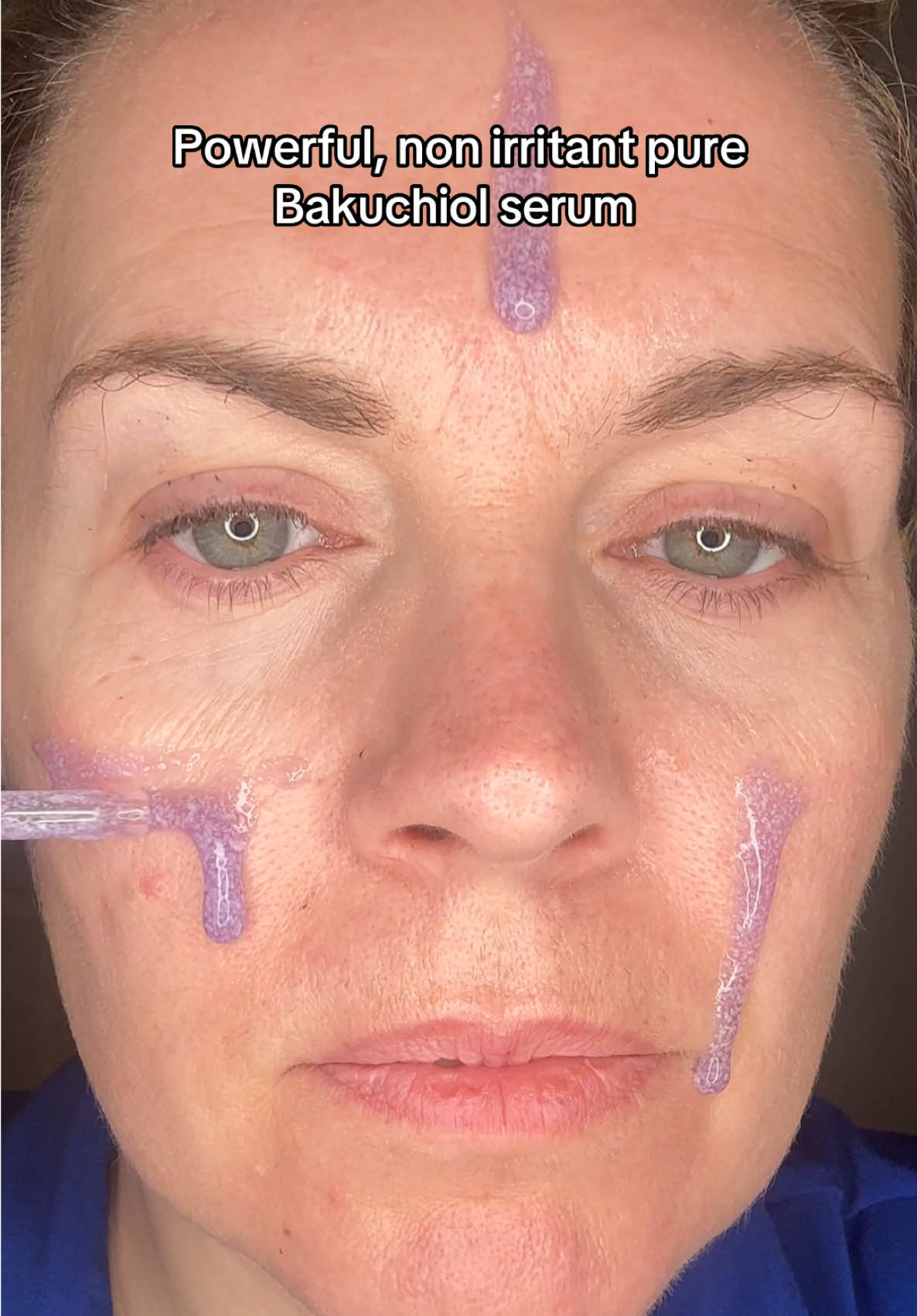 If you’re starting your journey with retinol or if you have sensitivity to retinol, and you want the results, but not the side effects then this serum is for you! @Eqqualberry  Find it in my cart 💜 #bakuchiol #bakuchiolserum #bakuchiolskincare #veganretinol #matureskincare #largepores #largeporesskincare #plumpskin 