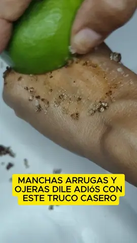 #manchas #arrugas #acné #manchasdesol 