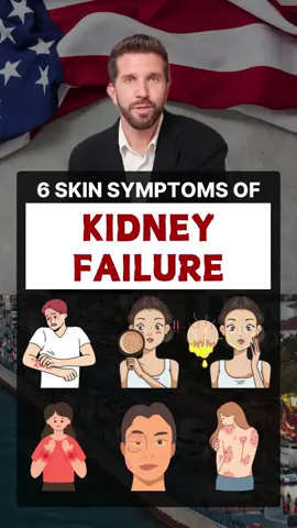 6 skin symptoms of kidney failure #healthy #healthcare #healthtips #healthyliving #nutrition #kidneyfailure #kidneydisease #kidney #skin 