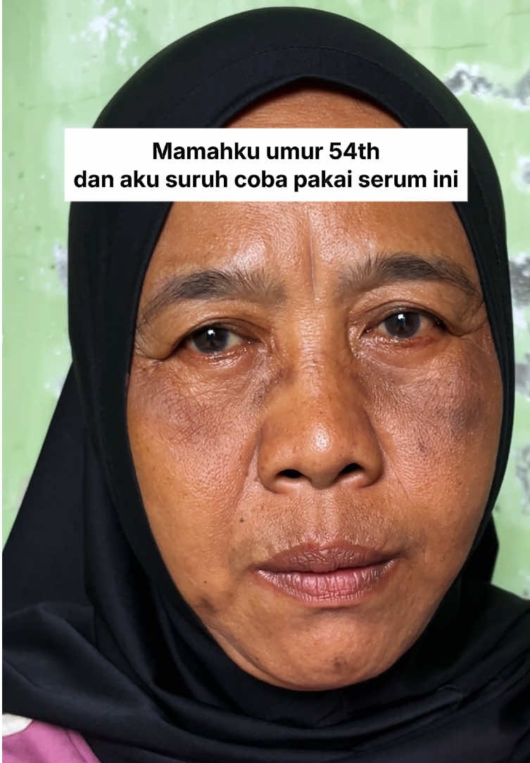 Umur 54 tahun tapi masih awet muda? Kok bisa?! 😱😱 Rahasianya Dark Spot & Anti Aging Serum Ozzaskin! 😍 ✅ Bantu samarkan flek hitam  ✅ Cerahkan wajah kusam  ✅ Kulit tampak lebih muda & glowing Pakai rutin biar hasilnya maksimal! 💜 Yuk, cobain sekarang & nikmati promo spesial Ramadan! 🌙🫰🏻 #OzzaskinbyOkiSetianaDewi #OzzaskinSkincare #RamadanEkstraSeru #GlowUpRamadanOzzaskin