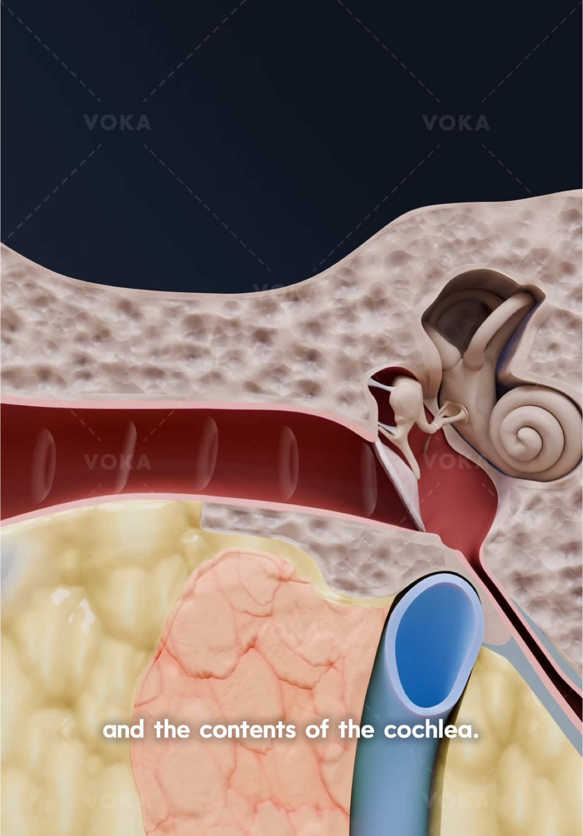🔊 How do we hear? The journey of sound through the ear explained in 3D   The auditory system is a fascinating structure that transforms sound waves into meaningful information.   👂 It all starts in the outer ear – the auricle captures acoustic waves, directing them through the external auditory canal to the eardrum. The vibrations then pass through the middle ear, where three tiny bones—malleus, incus, and stapes—amplify the sound and transmit it to the inner ear via the oval window.   🌀 In the inner ear, the cochlea takes over. Here, mechanical vibrations excite the organ of Corti, which contains hair cells that convert sound into electrical impulses. These signals travel via the vestibulocochlear nerve (cranial nerve VIII) to the auditory cortex of the brain, where sound is analyzed and recognized.   This complex process allows us to perceive speech, music, and the world around us!   Want to explore the auditory system in 3D? Check out VOKA Anatomy & Pathology!   #hearing #auditorysystem #ENT #anatomy #anatomy3d #3danatomy #medstudents #medicalstudents #medicaltsudent #digitallearning #humanbody