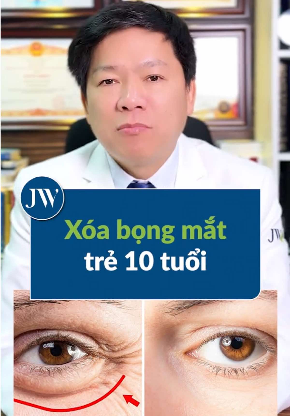 Bác sĩ Tú Dung BẬT MÍ phương pháp XÓA BỌNG MẮT trẻ ngay 10 TUỔI #BenhvienJW #BacsiTuDung #trehoamat #bongmat #xoabongmat #midface3in1 #xuhuong #phauthuatthammy #laohoa