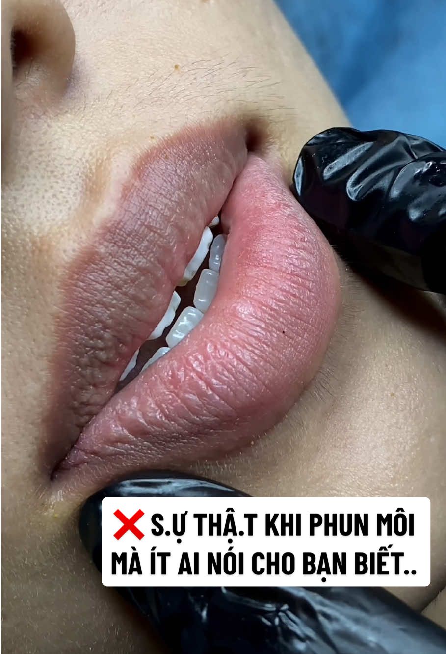 Sự thật khi phun môi mà ít ai nói cho bạn biết.. 👉🏻 bất ngờ ở cuối video ạ! #lamdep #xuhuong #trending #viral  #phunmoi #khuthammoi #phunmoitebaogoc #lips #phunxamthammy #phunmoinhatrang #phunxamthammychuyennghiep #pmu #moidep #phunxamthammynhatrang #khuthammoinhatrang #phunmoitunhien #phunmoidep #lipblush #TikTokAwardsVN #LearnOnTikTok 