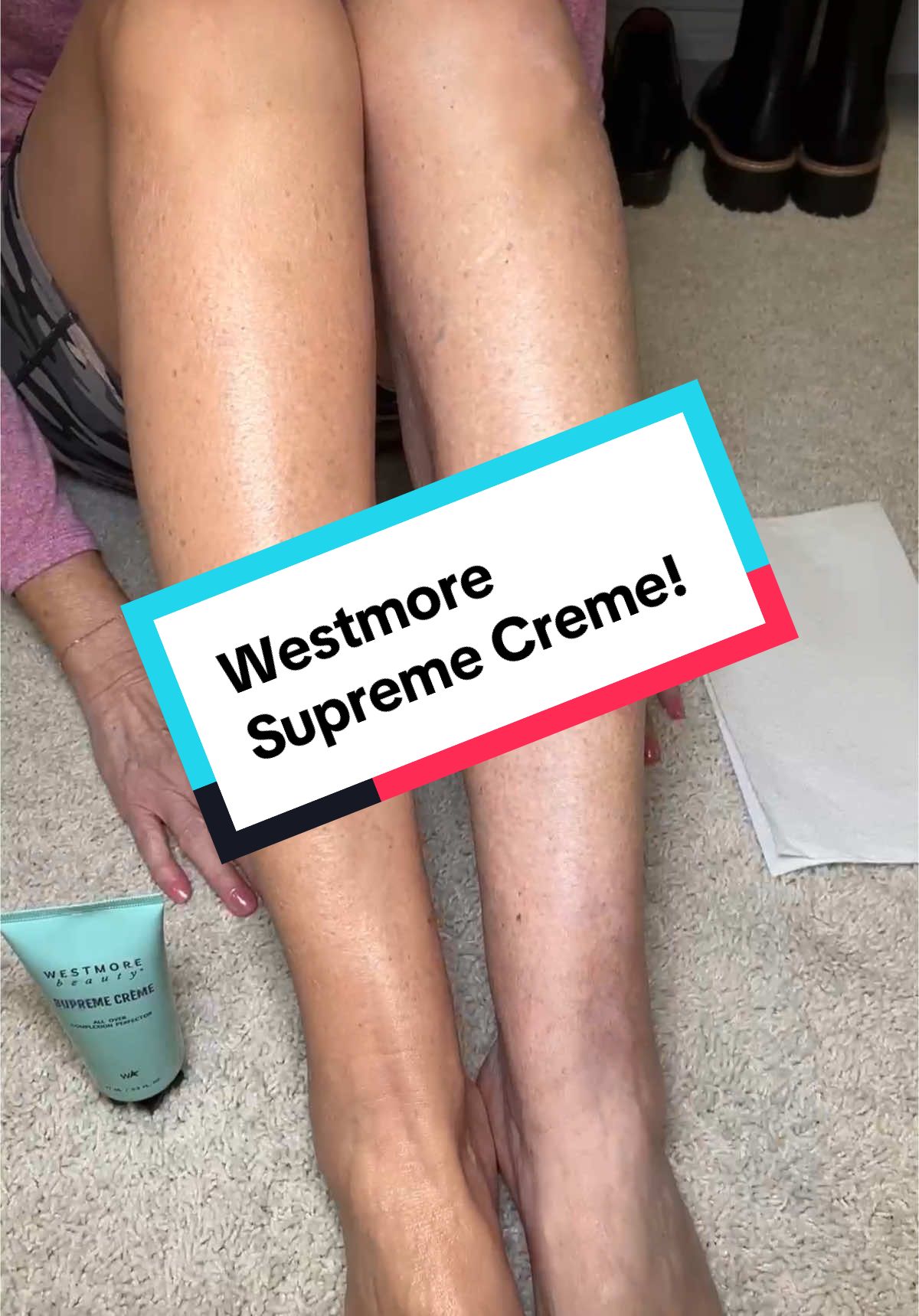Westmore supreme cream is your answer for amazing coverage. Supreme cream provides coverage of veins, scars and imperfections and gives me the confidence to wear shorts this summer. @Westmore Beauty #bodymakeup #trendingbeauty #foundation #flawlessskin #coverage #makeup 