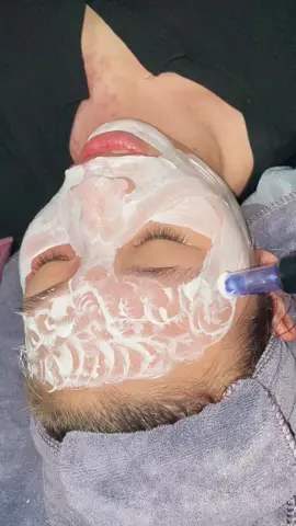 Đầu kim nano cấy trắng cấy tảo #xuhuongtiktok #xuhuong #kimnano 