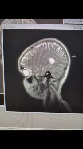 when You have to go get an MRI brain scan with contrast and you take home your CD to play pretend doctor until the doctor tells me if there's a tumor or not🧍‍♀️ hopefully not that but wanted to rule it out since I've been having seizureish episodes #mri #xray #sezuires 