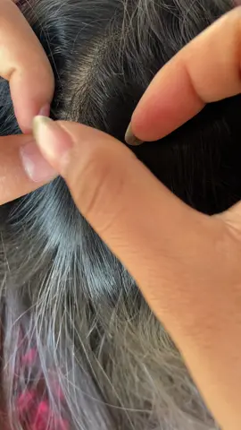 Remove nits first to get rid of the lice completely. 😱😬😭#omg #lice #liceremoval #trending #satisfatorio #tiktokindia 
