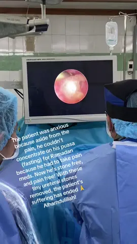 The patient was anxious because aside from the pain, he couldn’t concentrate on his puasa (fasting) for Ramadan because he had to take pain meds. Now he’s stone free, and pain free!With these tiny ureteral stones removed, the patient’s suffering has ended 🙏 Alhamdulillah! Done in St. Louis Hospital - Tacurong City using Quanta Holmium LASER 150W. Thanks to the amazing staff of St. Louis Hospital - Surgery Department :)