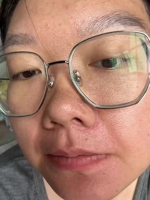 “Miếng dán mụn đầu đen + nước se khít lỗ chân lông, kết hợp đôi, da mịn màng đến bất ngờ!”