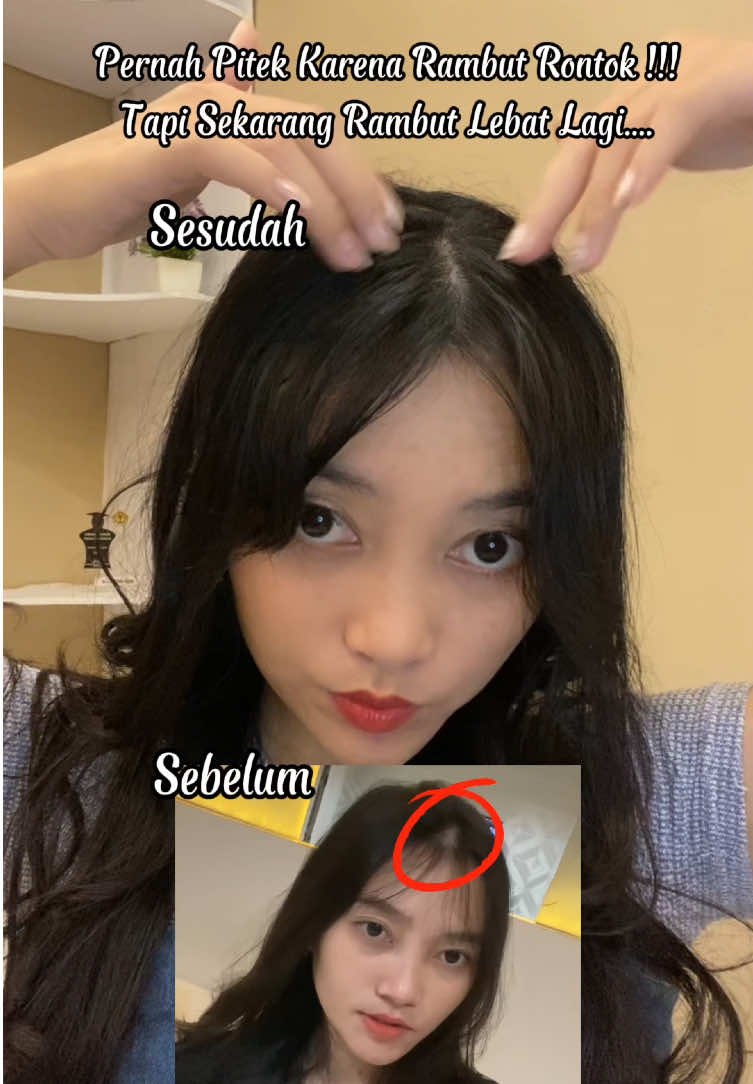 Yang rambutnya pitek gara gara rontok parah ini cocok buat kalian atasi masalah rambut rontok kalau ga percaya kalian cobain sendiri aja dulu ya!! Co nya dikerkun aku ya karna aku pake produk dikerkun aku... #torrential #torrentialessentialhairserum 