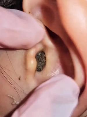 אתם לא מאמינים כמה שעווה נשארת באוזניים שלכם! 