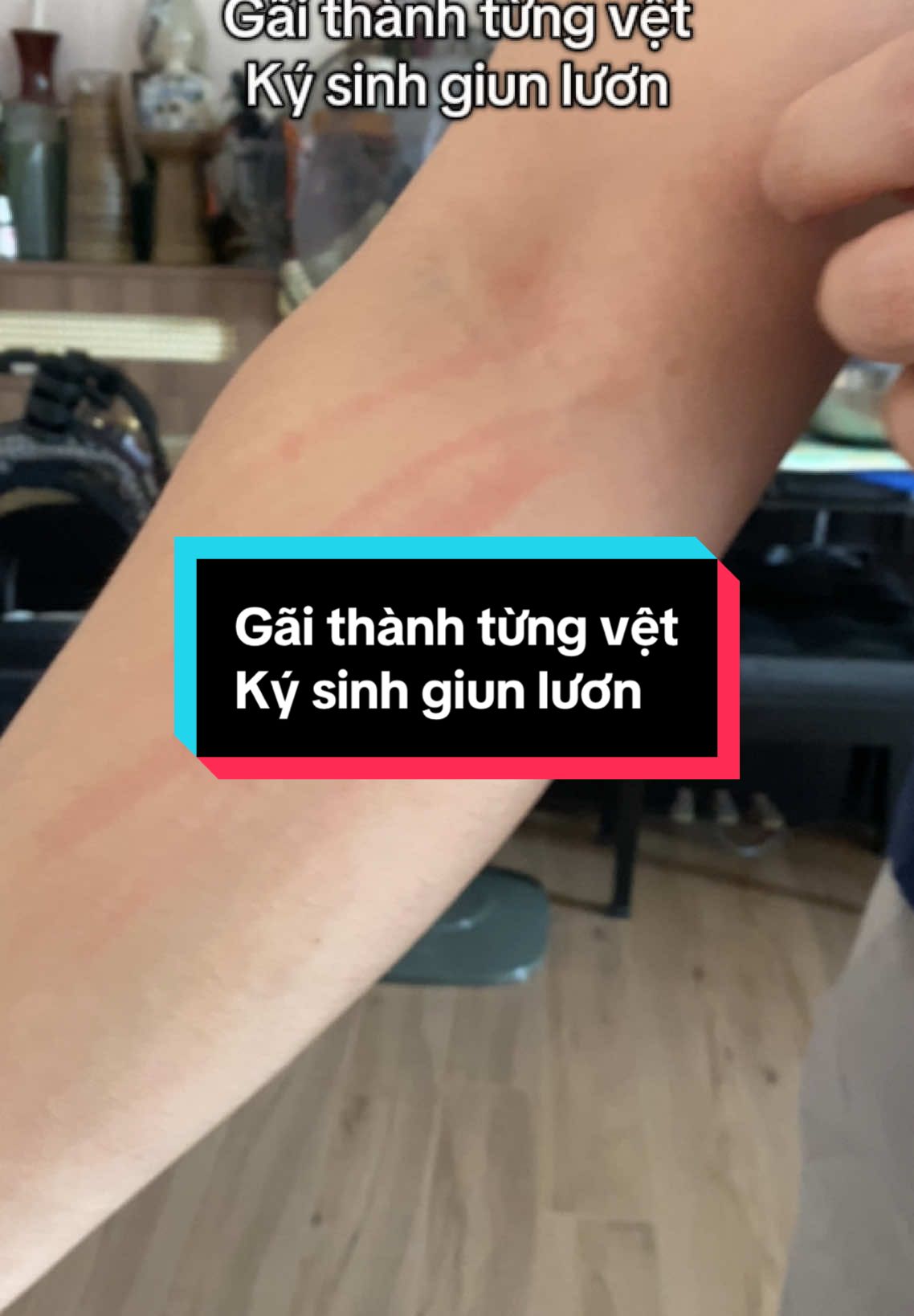 Gãi thành từng vệt Ký sinh giun lươn#nguanhudien #gaicanhcach #nguaramrankhapnguoi #sanchomeo 