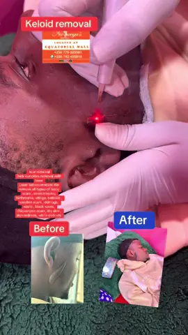 #viral_video #kampala_uganda🇺🇬🇺🇬🤝 #foryoupage❤️❤️ #trending #bodyslimming #viral #viral 