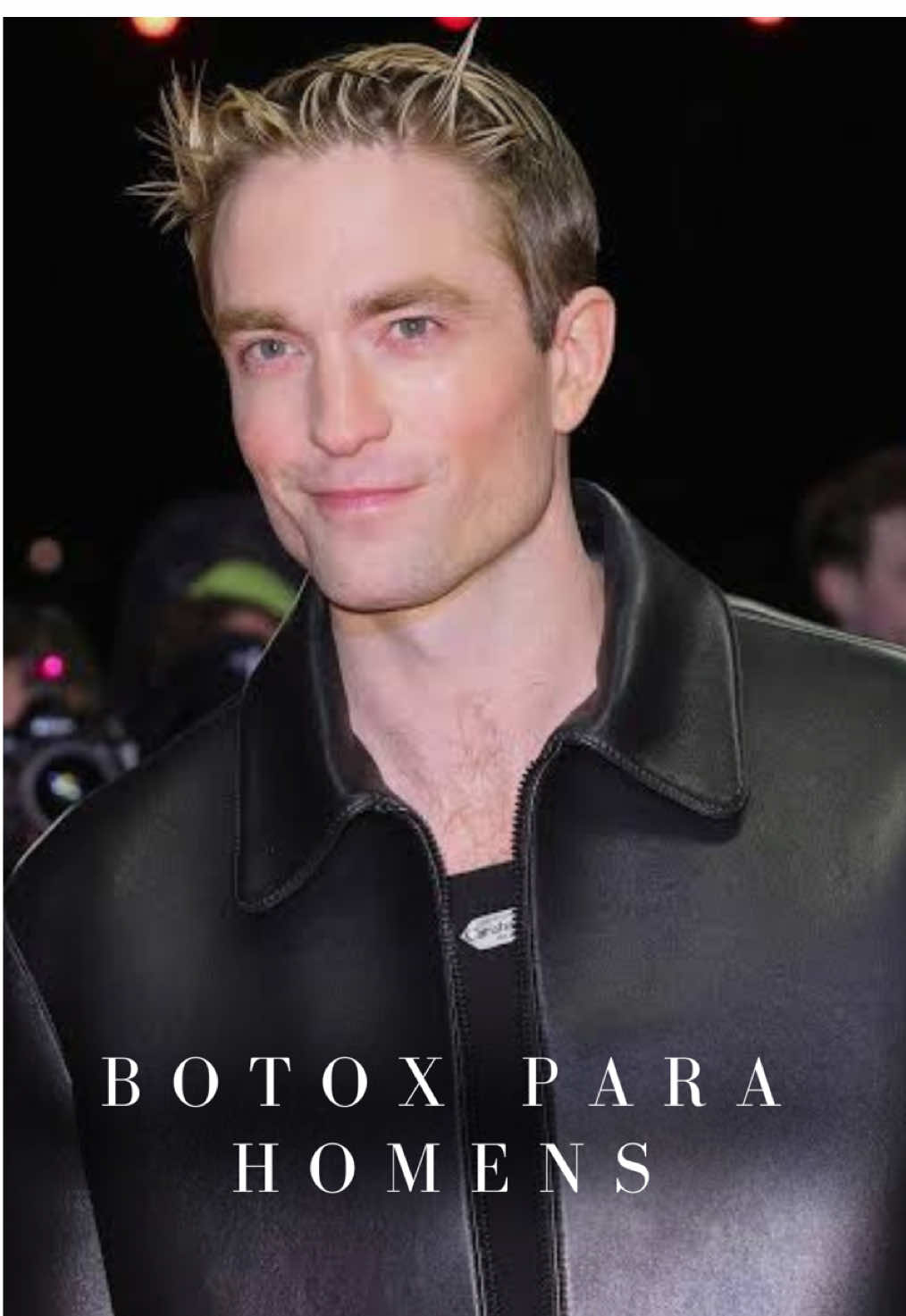 Botox não é apenas para mulheres! Um ótimo exemplo disso é Robert Pettison, que passou por uma transformação sutil e elegante, melhorando o contorno dos traços sem perder a naturalidade. O Botox pode suavizar rugas, valorizar a expressão e proporcionar um aspecto mais descansado e rejuvenescido, tanto para homens quanto para mulheres  #dermatology #clinicafabianapietro #botox #toxinabotulinica #robertpattinson 