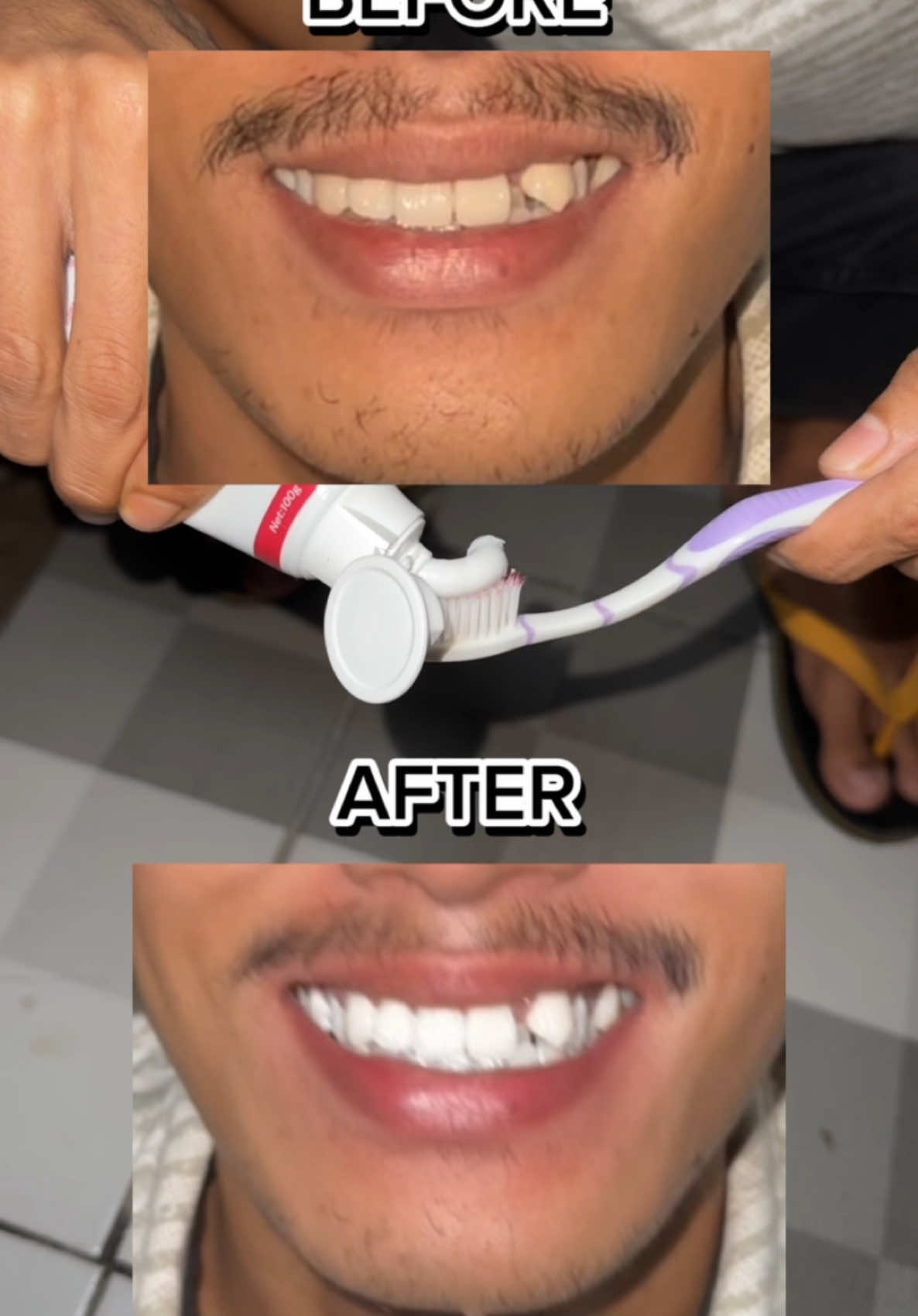 wajib punya stock gak sih tanpa harus ke dokter dulu #Metoo #PembersihGigi #Pemutihgigi #MetooSmile #MetooBeauty #MetooToothPaste #ToothPaste #MetooMW3 #PastaGigi #viralvideo #viraltiktok 