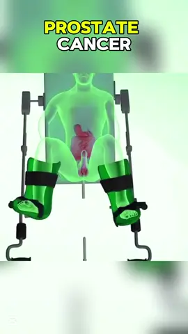 Prostate cancer  #surgery #prostat #prostatitis #prostatacancer #prostatic #prostatcancer #cancer #cancersucks #cancerfighter #cancersurvivor #cancer♋️ #cancerprostata #cancerprostada #cancerprostagestage5 