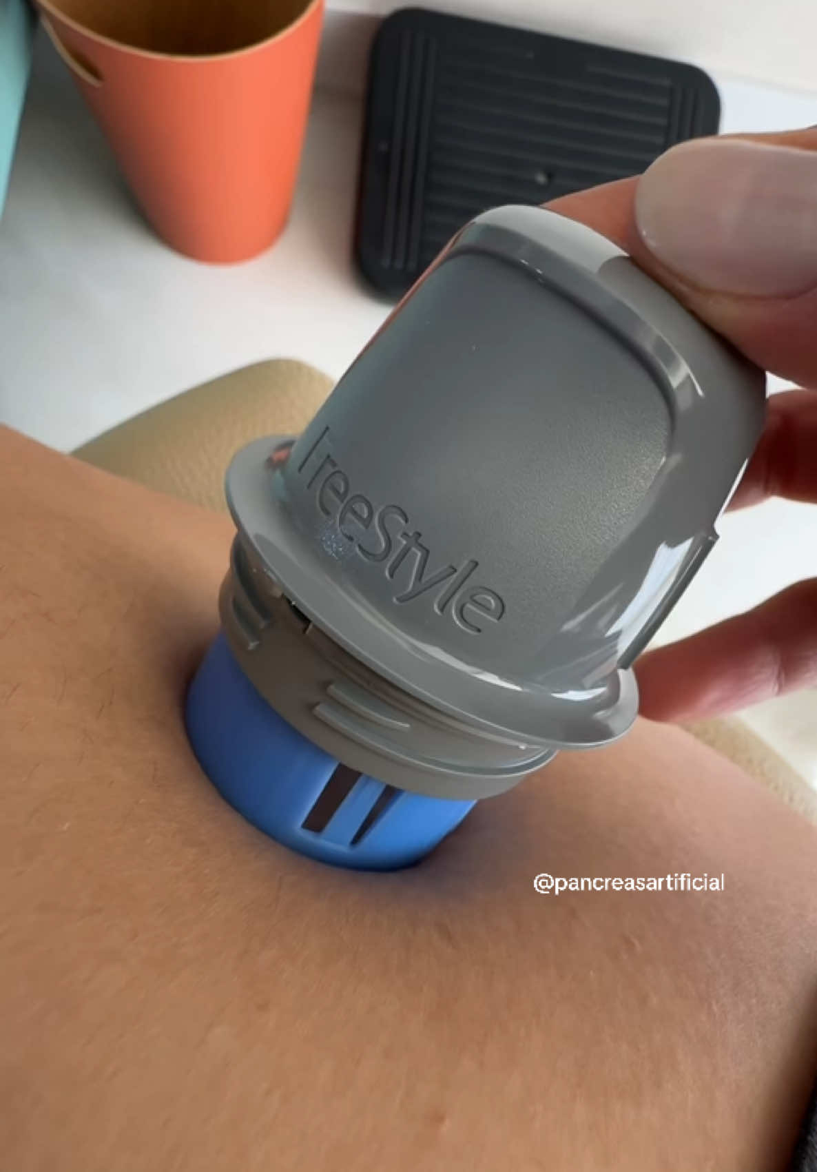 Trocando meu sensor de glicose freestyle libre #diabetes #diabetestipo1 #freestylelibre 