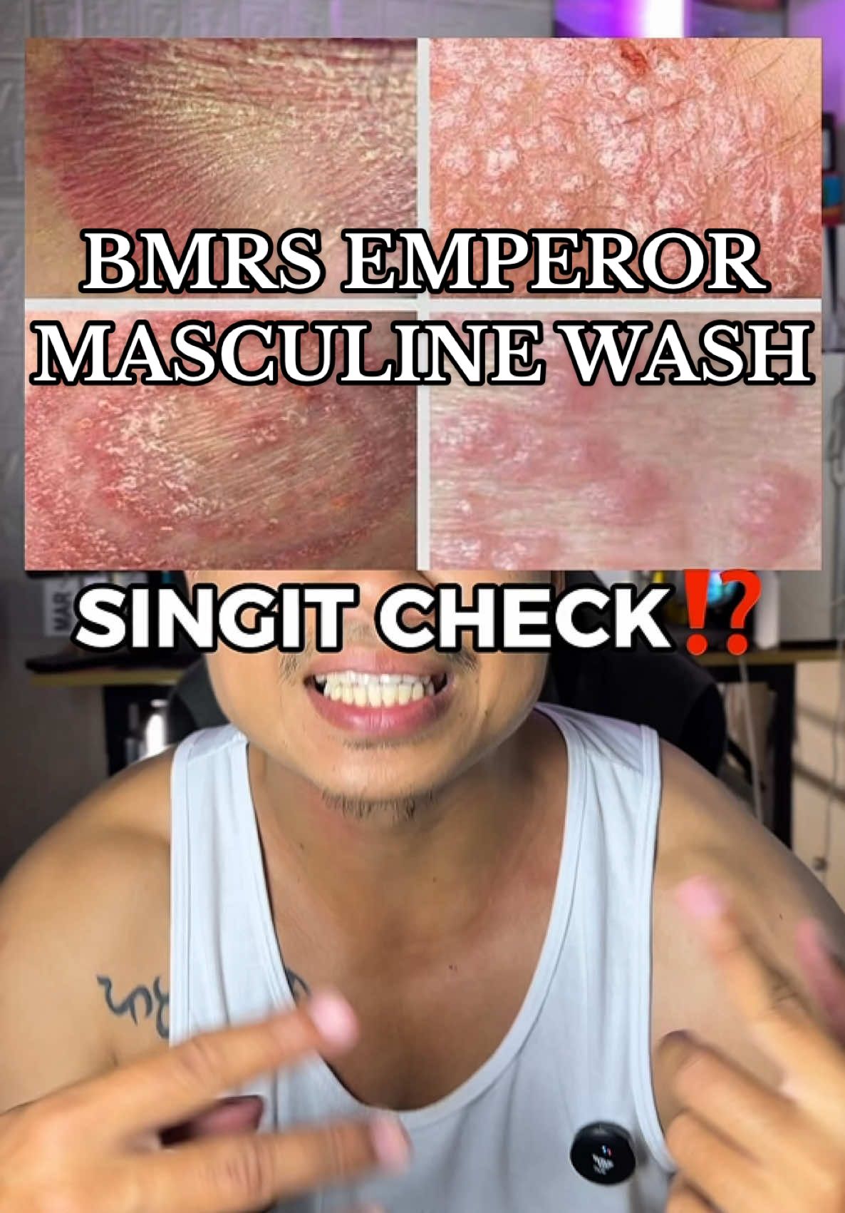 Icheck nyo yung singit nyo kung may ganyan na rin ba? 🤔 If kung meron palitan nyo na yung sabon nyo at gumamit kayo ng BMRS Emperor Masculine Wash.  Nakaktulong ang Masculine Wash para maprevent natin yung fungal infections ✨🙌🏻 #bmrsemperormasculinewash #bmrsemperorintimatewash #emperormasculinewash #masculinewash #intimatewash 