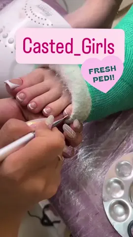 French Pedicure in a Short Leg Cast #legcast #brokenankle ##brokenleg #gips #yeso #crutches #frenchpedicure #frenchtoes #frenchnails #pedicure #pedicuretools 