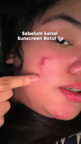 gong bener sunscreen botol ijo ini buat acneprone kaya aku 🙏🏻🙂‍↕️ #sunscreen #sunscreenviral #acneproneskin 