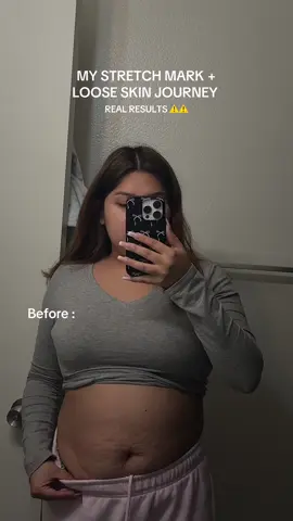 ⚠️ please be respectful ⚠️ it took guts to show my body especially my before. I finally feel like I got my confidence back and wanted to share this incase anyone is struggling with the same✨🤎 #bodygoalz #maelyscosmetics #maelys #stretchmarks #postpartum #bodytransformation #transformationchallenge 