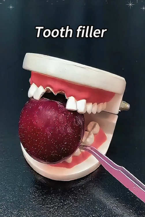 Got a chipped tooth? 🦷 Fix it at home with this innovative dental repair material! Strong enough to chew and bite after fixing—it's a total lifesaver! 🛒✨ #ToothRepair #DentalCare #MustHave #TikTokFinds #PracticalGoods #viralproducts